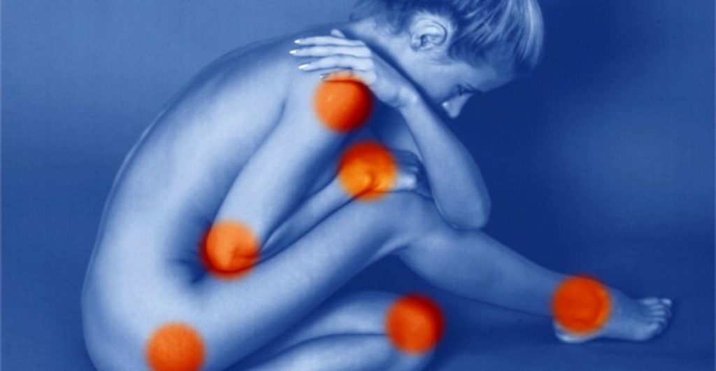 tratamentul simptomelor reumatismului umărului artrita metatarsica