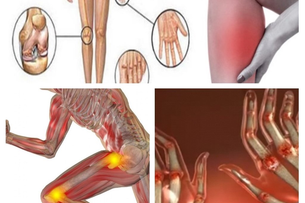 semne de tratament pentru artrita artrita